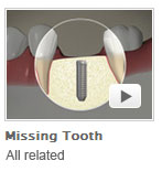 Implant Dentistry Videos