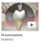 Preventative Sealants